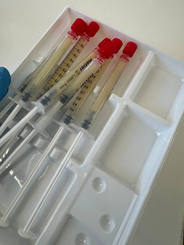 Próbki przygotowane do użycia w zabiegu