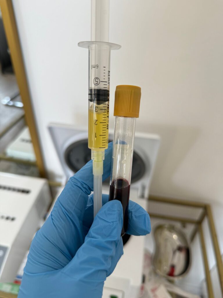 Próbki krwi do czyszczenia