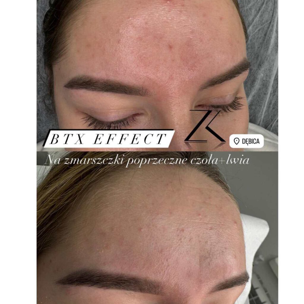 Zdjęcie wykonane po zabiegu