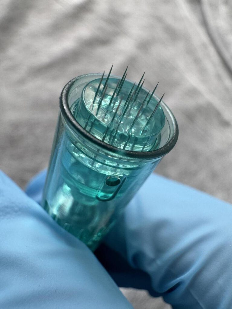 Końcówka do mezoterapii igłowej