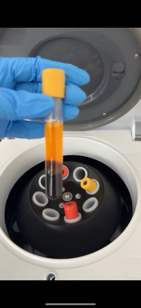 Próbka krwi do oczyszczenia 